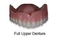 Full upper denture