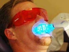 Zoom Laser Whitening