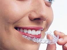 Invisalign retainer